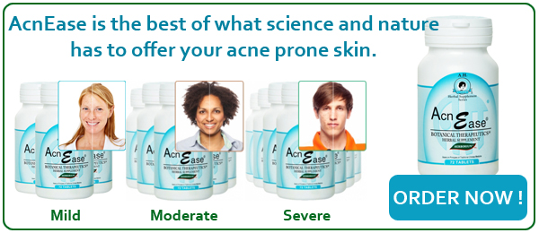 Order AcnEase Today!